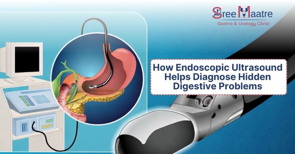 How Endoscopic Ultrasound Helps Diagnose Hidden Digestive Problems